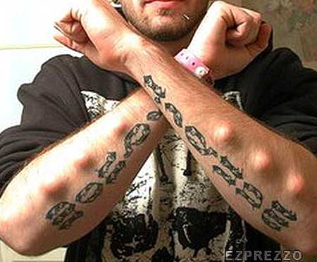 implanted arms