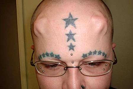 head implants